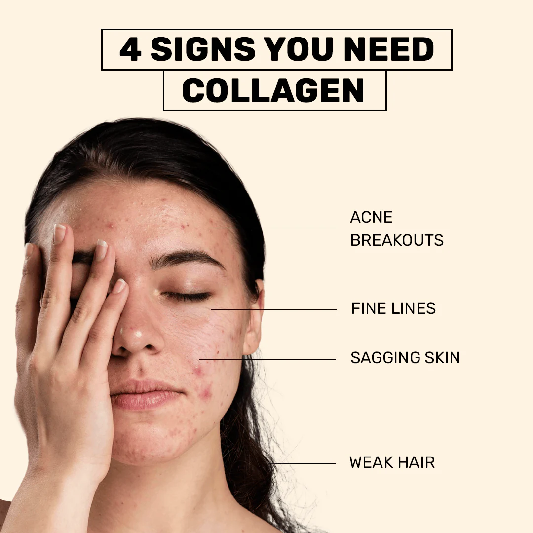 Anti-Acne Collagen - Image 7